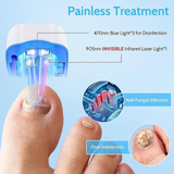 Antifungal Laser Nail Device