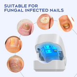 Antifungal Laser Nail Device